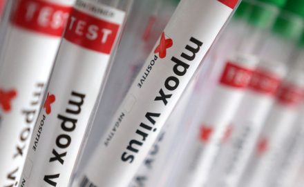 Ribercon - Sobe para 140 número de casos confirmados de Mpox no país, em 2026
