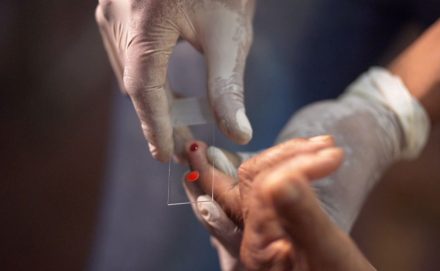 Ribercon - SUS começa a usar novo tratamento contra a malária em crianças